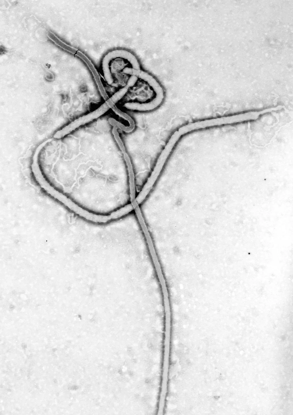 An electron micrograph of an Ebola virus particle showing the filamentous Filoviridae structure.